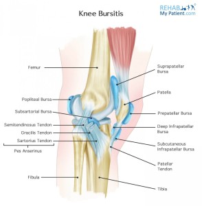 knee_bursitis